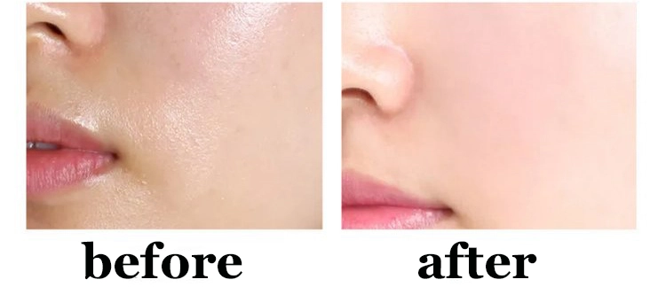 Supporting Copper Peptide Ghk Cu Powder for Wrinkles Supporting Copper Peptide Ghk Cu Powder for Wrinkles