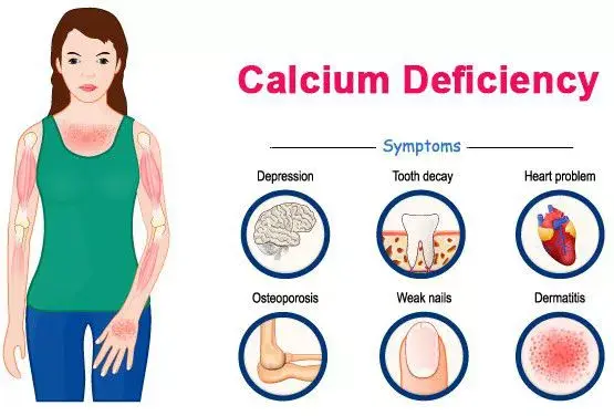 Digestive Discomfort Related to Calcium Digestive Discomfort Related to Calcium